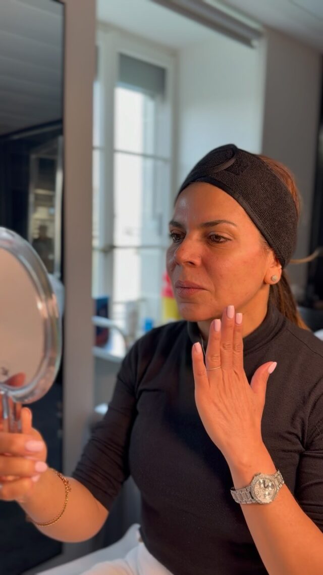 📢 Offre spéciale — 30% de réduction sur les injections d’acide hyaluronique jusqu’à fin juin ! 💉✨

Notre patiente Irène suit la deuxième étape de son traitement de restauration du volume et de la structure du visage. À ce stade, le soutien de l’arc zygomatique et de la mandibule est renforcé, ainsi que la correction de l’angle mandibulaire.

Le résultat : une atténuation visible des plis nasogéniens grâce à un effet naturel de lifting cutané, une restauration nette de l’ovale du visage et une amélioration du contour des joues.

Les préparations effectuées au niveau du menton ont permis d’obtenir un résultat à la fois naturel et spectaculaire.

🌟 Vous souhaitez rajeunir et revitaliser votre visage ? Profitez de -30% sur les injections d’acide hyaluronique — uniquement jusqu’au 30 juin !

📲 Récupérez votre bon de réduction dans nos stories à la une
Ou laissez un « + » en commentaire, nous vous enverrons votre bon personnellement !

Envie de découvrir la transformation d’Irène ? Suivez nos prochaines publications !