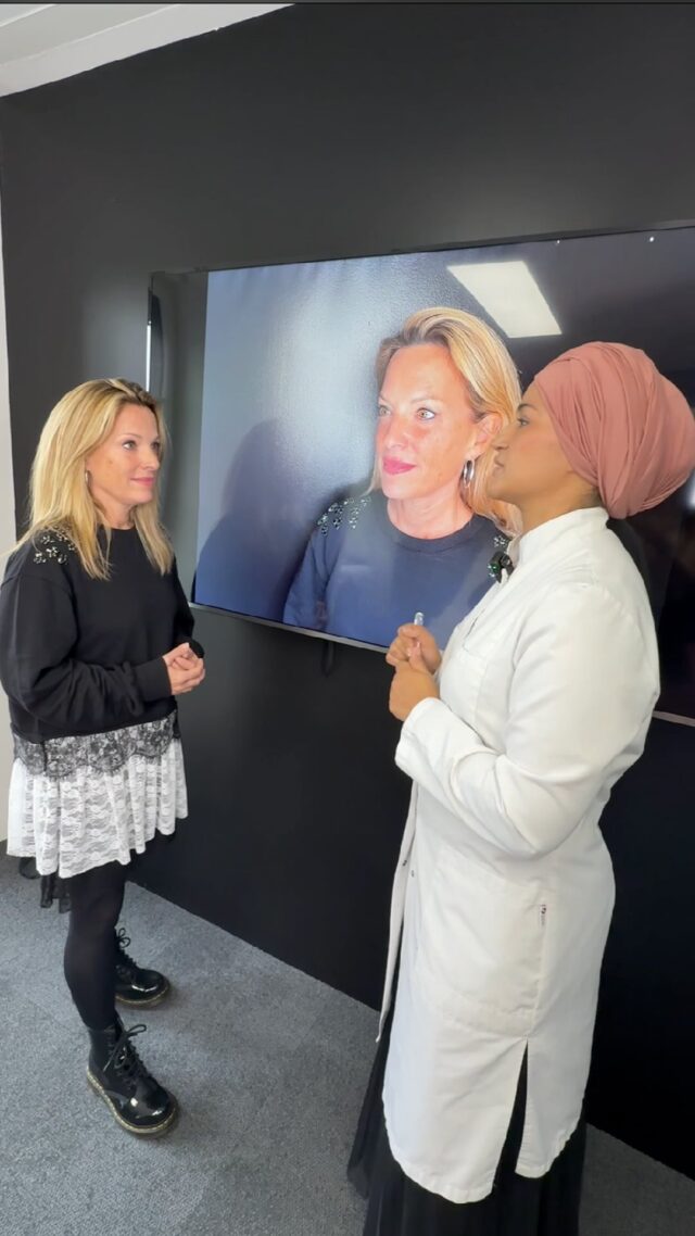 La peau reflète toujours ce que traverse notre organisme — le stress, les changements hormonaux, l’âge, et parfois les conséquences d’un traitement lourd. 

⚪Dans ces périodes, elle devient plus fine, plus sèche, plus sensible et perd plus rapidement son élasticité. 🩶
L’histoire de Maëlle est particulière et profondément inspirante. ⚫
Après la chimiothérapie, sa peau a connu ces changements : diminution de la densité, sécheresse marquée, perte d’élasticité et apparition de fines lignes autrefois imperceptibles.
C’est une réaction naturelle de la peau face à une charge importante — et beaucoup s’y reconnaissent, même sans avoir vécu un cancer. ◻️
C’est pourquoi l’une des questions les plus fréquentes que nous recevons est :
« Peut-on faire des injections lorsque la peau est affaiblie ou après une chimiothérapie ? »
La réponse des spécialistes est claire :
Oui, c’est possible, mais il est essentiel de choisir le bon moment. 🖤
Après un traitement intensif, il est généralement recommandé d’attendre environ 6 mois — et si l’état est stable, il n’existe pas de contre-indications aux traitements injectables.
Dans ces situations, les injections ne sont pas une intervention agressive, mais un soutien local et délicat pour la peau.

⚪La docteure Monia Khedir a élaboré pour Maëlle un plan de restauration doux, visant à :
◼️ améliorer la densité cutanée
◼️ renforcer l’hydratation
◼️ stimuler l’élasticité
◼️ lisser les petites irrégularités de texture
◼️ réduire la pigmentation

Progressivement, la peau de Maëlle a retrouvé une surface plus uniforme, une meilleure densité et un tonus naturel.

💫Le résultat — dans la prochaine vidéo. 🩶

🖤L’idée essentielle est simple :
🤍lorsque le moment est bien choisi et que l’approche repose sur la médecine et le respect du corps, les injections deviennent un moyen sûr et efficace de soutenir la peau, même après les étapes les plus difficiles de la vie. 

#médecinesthétiquegenève#aestheticsclinic#skinboostersgeneva#softliftgeneva#stimulercollagène#octoberrose#skinrecovery