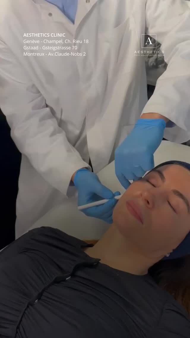 Profhilo STRUCTURA is not a filler.
It is a bioremodeling treatment that works by stimulating collagen and improving skin quality from within.

Thanks to its hybrid hyaluronic acid complexes, it:

• deeply hydrates the skin
• improves elasticity and firmness
• enhances skin texture
• restores natural glow

The product spreads evenly across the skin, allowing for maximum effect with minimal injections.

✨ The result is smoother, firmer and more radiant skin — naturally and progressively.

SPRING SKIN REPAIR –40%

You can purchase your treatment program
online in our Highlights (SKIN REPAIR).

Book your consultation to find the best approach for your skin.