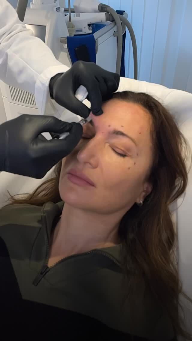 Aging is a natural process.

The first wrinkles and facial changes are not a problem, but a signal that it’s time to take care of yourself.

Modern aesthetic medicine doesn’t change you.
It helps preserve your features, freshness, and natural look over time.

But it’s important to understand:
the result depends not on the procedure, but on the approach.

BTX is a tool.
And when used incorrectly, it can take away your facial expressions and individuality.

A refined approach is always about balance:
✔ maintaining natural expression
✔ softening wrinkles, not erasing emotions
✔ enhancing your features, not changing them
This is what creates results that look elegant and natural.

👉 Book a consultation — our experts will find the right solution for you

#aestheticsclinic#softliftinggeneva#removewrinkles#drTenorio