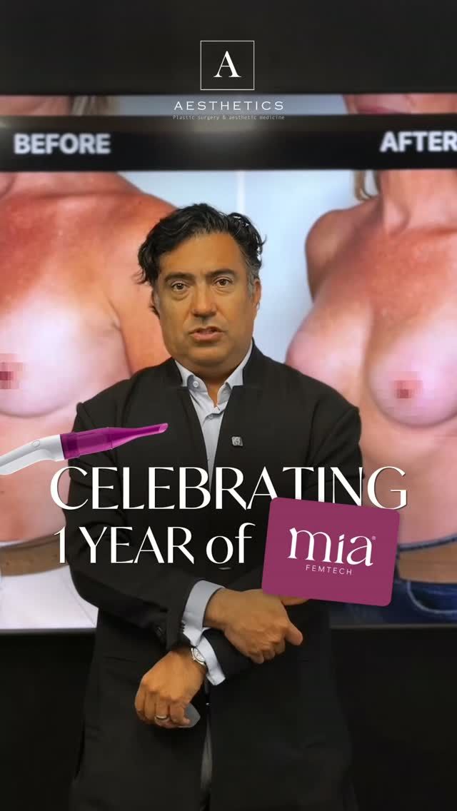 It’s been one year since Dr. Xavier Tenorio began performing breast augmentation using the MIA Femtech™ technique at Aesthetics Clinic. ✨

Over the past year, Dr. Tenorio has performed numerous procedures, and patients are already enjoying their results and their new body contours.

What makes MIA Femtech™ special?

• A small incision in the armpit
• Local anesthesia
• No incisions on the breast itself
• Returning home on the same day

During this first year, Dr. Tenorio has also gained experience with a revision procedure performed through the same small incision, demonstrating that this approach was feasible in that particular case.

MIA Femtech™ is a modern, minimally invasive approach to breast augmentation designed to minimize surgical intervention.

Wondering if this technique could be right for you?

Book a consultation with Dr. Xavier Tenorio at Aesthetics Clinic to discuss your expectations and explore your options.

📩 Book your consultation via the link in our bio.